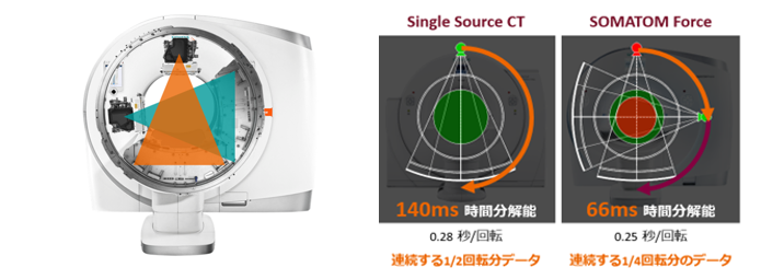 2組のX線管と検出器による超高速スキャン